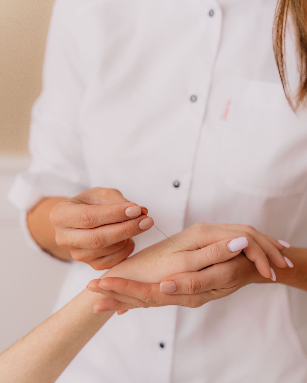 An acupuncturist placing a fine needle in a patient's hand